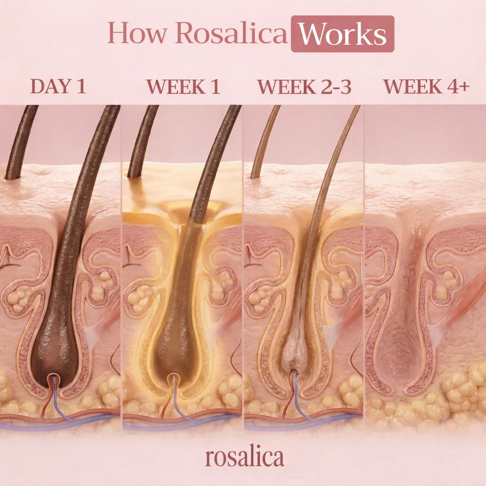 Rosalica Cyperus Rotundus Oil Hair Reduction Formula